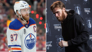 Connor McDavid spelade skadad i Stanley Cup-slutspelet