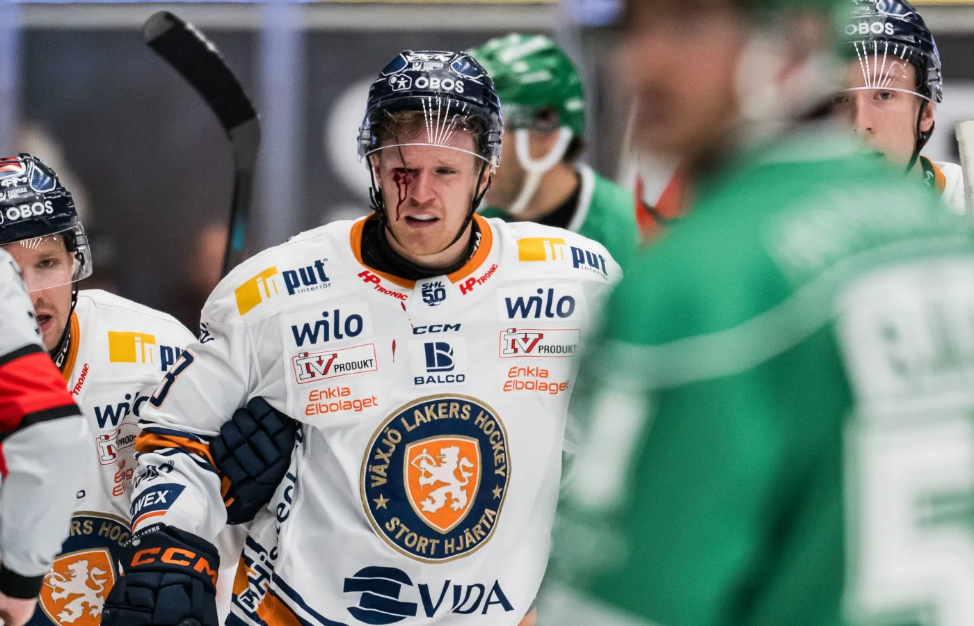 Tvingas till ingrepp – drabbad av allvarlig ögonskada