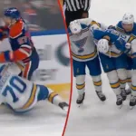 Svenskens otäcka skada – efter närkampen med McDavid