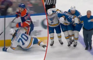 Svenskens otäcka skada – efter närkampen med McDavid