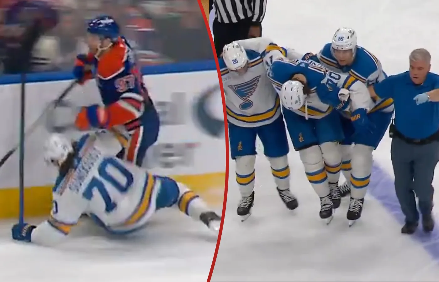 Svenskens otäcka skada – efter närkampen med McDavid