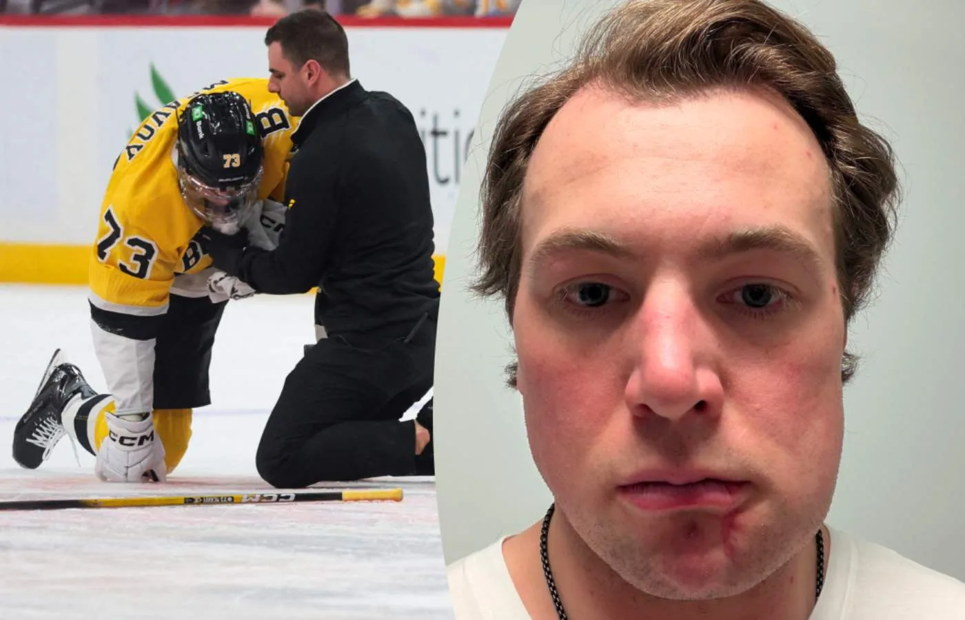 OS-stjärnans svar – visar upp skadan