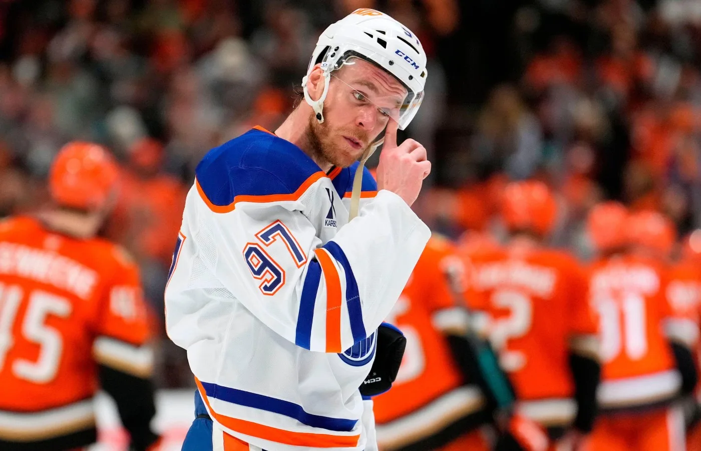 Connor McDavid fraktur